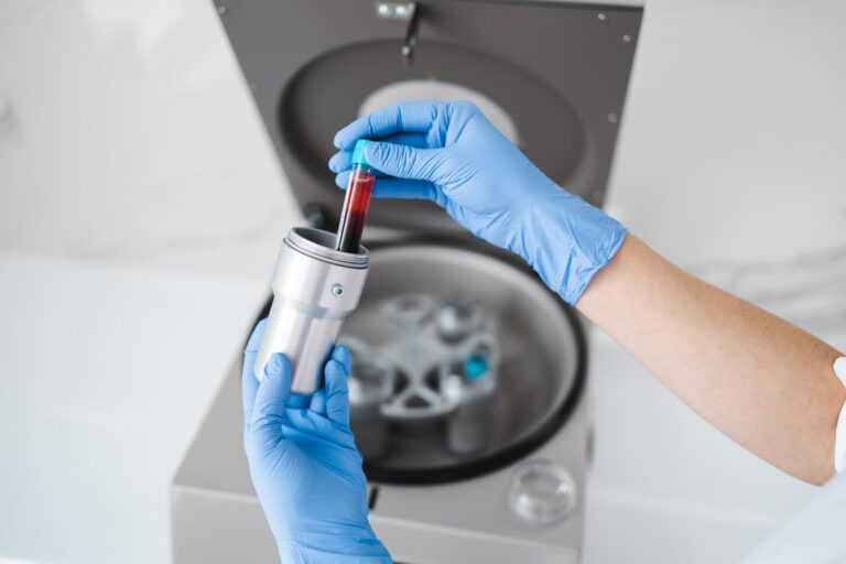 Separator zanieczyszczeń magnetycznych – Ochrona pomp obiegowych