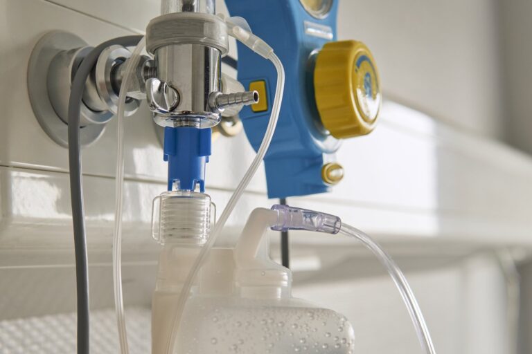 Jak prawidłowo zamontować zawór odcinający do pralki